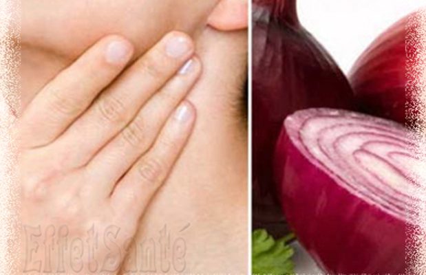 santé, médecine, glande thyroïde, cancer thyroïde, oignon