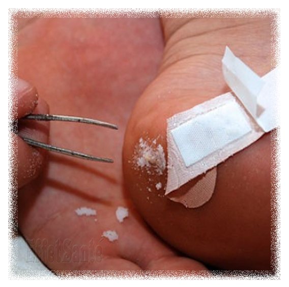 ail, santé, effet sur la santé, médecine, naturelle, naturel