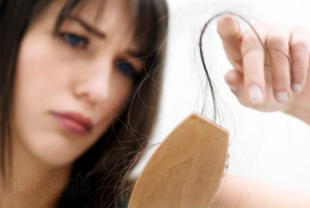 Alopécie,perte de cheveux, cheveux qui tombent, quoi faire avec cheveux qui tombent, masque cheveux, santé de cheveux, vitamines et mineraux pour les cheveux