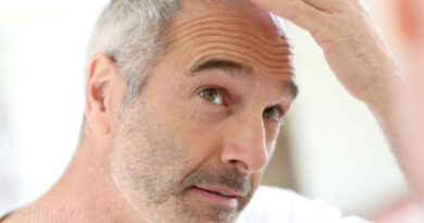 pertes de cheveux, Alopécie,perte de cheveux, cheveux qui tombent, quoi faire avec cheveux qui tombent, masque cheveux, santé de cheveux