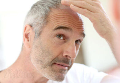 pertes de cheveux, Alopécie,perte de cheveux, cheveux qui tombent, quoi faire avec cheveux qui tombent, masque cheveux, santé de cheveux
