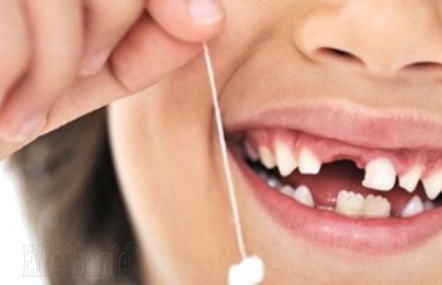 changement de dents, quand tombent les dents de lait, changement de dents de lait, les dents de lait