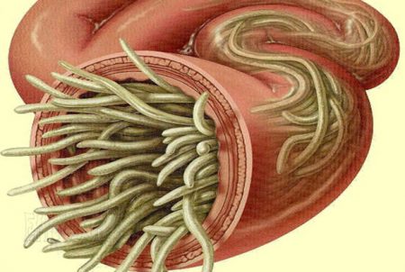 parasites, comment se soigner de parasites, si on a des parasites