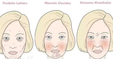 mauvais glucides, produits laitiers, santé de la peau, acné, sébum