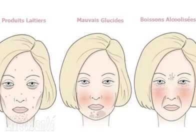 mauvais glucides, produits laitiers, santé de la peau, acné, sébum