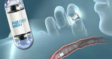 vidéocapsule, capsule vidéo, vidéo endoscopie