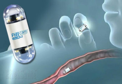 vidéocapsule, capsule vidéo, vidéo endoscopie
