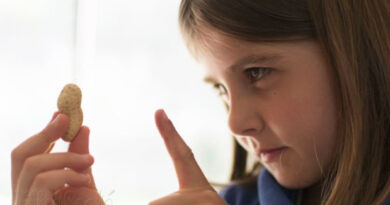 allergie aux arachides, allergies alimentaires