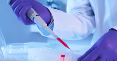 traitement VIH, VIH, HIV, comment guérrir VIH