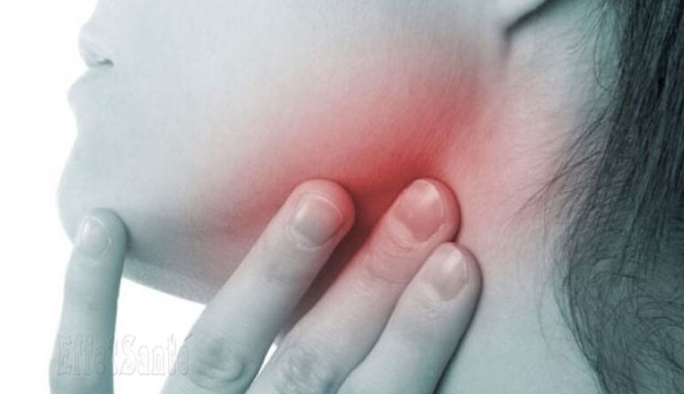 cancer de la gorge, virus VIH, sida, virus HPV,