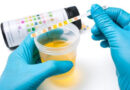 urine, couleur d'urine, urine, maladie