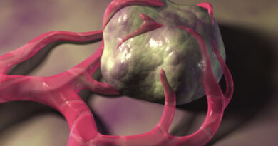 cancer, substances chimiques, produits chimiques, ce que cause le cancer, le sucre et le cancer,