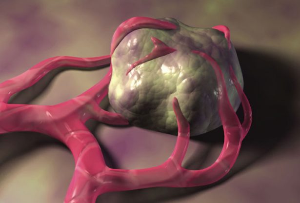 cancer, substances chimiques, produits chimiques, ce que cause le cancer, le sucre et le cancer,