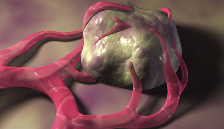 cancer, substances chimiques, produits chimiques, ce que cause le cancer, le sucre et le cancer,