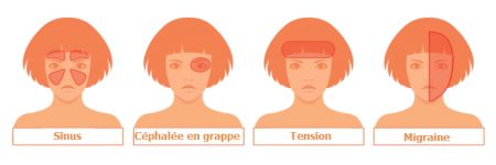 mal de tête, maus de tête, migraine, céphalée