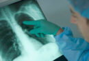 Emphysème pulmonaire, maladie du poumon, maladie pulmonaire, cancer du poumon