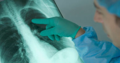 Emphysème pulmonaire, maladie du poumon, maladie pulmonaire, cancer du poumon