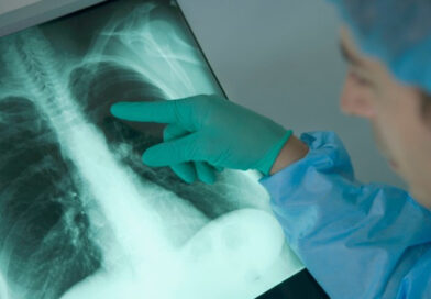 Emphysème pulmonaire, maladie du poumon, maladie pulmonaire, cancer du poumon