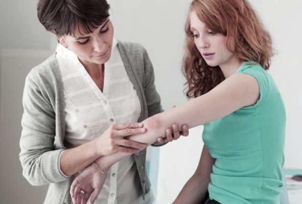 psoriasis, le psoriasis, von zumbusch, maladies de la peau