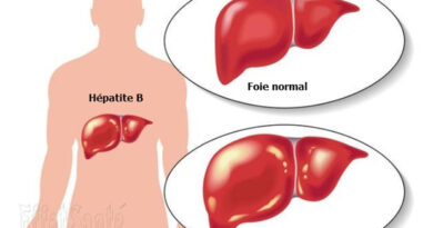 hépatite B, maladies du foie, hépatite, l'hépatite