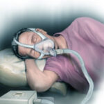 apnée du sommeil, apnée, respiration difficile, poumons malades, poumons, les poumons, les bronches, maladies de poumons