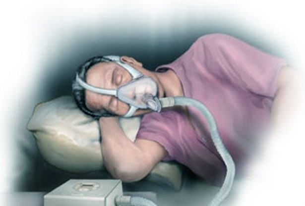 apnée du sommeil, apnée, respiration difficile, poumons malades, poumons, les poumons, les bronches, maladies de poumons