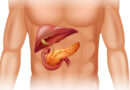 cancer du pancreas, pancréas, le cancer, le pancréas, cancer du pancréas