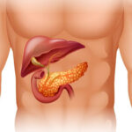 cancer du pancreas, pancréas, le cancer, le pancréas, cancer du pancréas