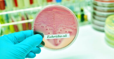 E. coli, escherichia coli, infection à e coli,