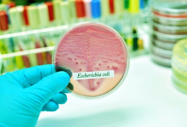 E. coli, escherichia coli, infection à e coli,
