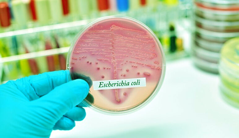 E. coli, escherichia coli, infection à e coli,