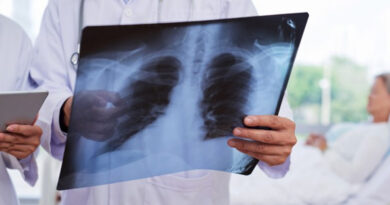 maladies pulmonaire, poumons, cancer du poumon