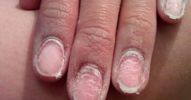 manucure semi permanente, vernis à ongles, vernis-gel à ongles, gel à ongles