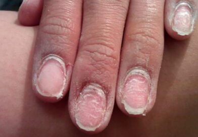manucure semi permanente, vernis à ongles, vernis-gel à ongles, gel à ongles