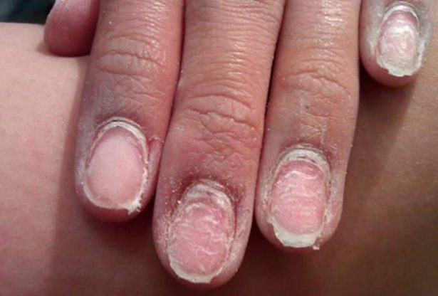 manucure semi permanente, vernis à ongles, vernis-gel à ongles, gel à ongles