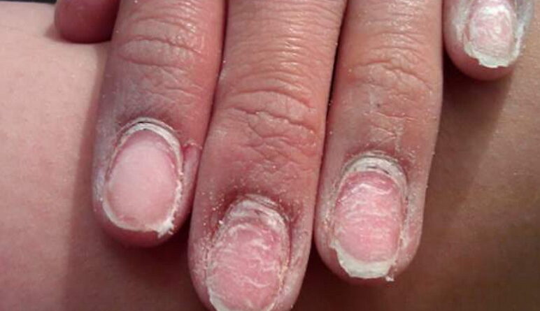 manucure semi permanente, vernis à ongles, vernis-gel à ongles, gel à ongles