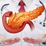 la pancréatite, maladies du pancréas, cancer du pancréas, douleur abdominale