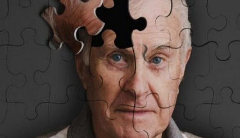 maladies d'Alzheimer, l'Alzheimer, Alzheimer, démence