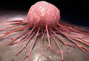 cancer, le cancer, les cellules cancereuses, les causes de cancer, traitement cancer