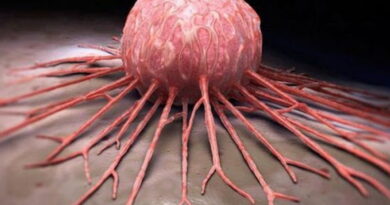 cancer, le cancer, les cellules cancereuses, les causes de cancer, traitement cancer