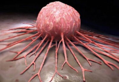 cancer, le cancer, les cellules cancereuses, les causes de cancer, traitement cancer