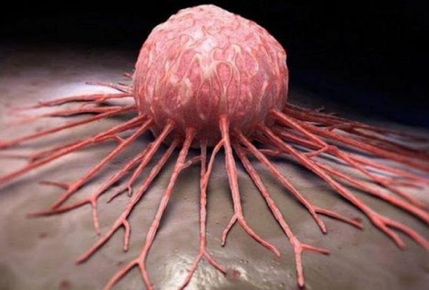 cancer, le cancer, les cellules cancereuses, les causes de cancer, traitement cancer