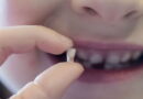 dents de lait, dents de requin, dents permanents,causes dents superposées, extraction dent de lait