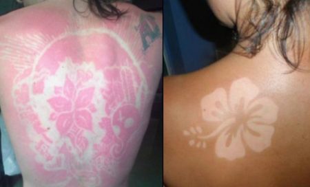 mélanome, cancer de la peau, cancer peau, tumeur peau, maladies de la peau, maladies peau