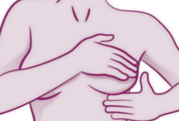cancer du sein, cancer, la vitamine D