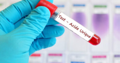 l'acide urique, la goutte, les maladies des articulations, les articulations, mal aux articulations