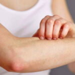 maladies de la peau, la peau, cancer de la peau, la dermatite, les démangeaisons,