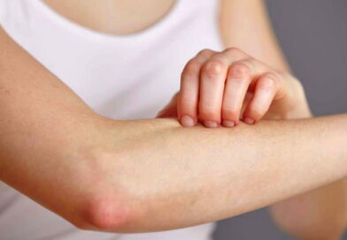 maladies de la peau, la peau, cancer de la peau, la dermatite, les démangeaisons,