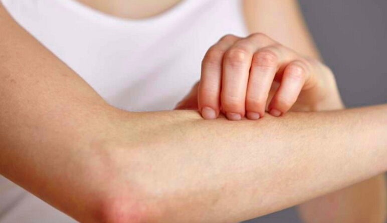 maladies de la peau, la peau, cancer de la peau, la dermatite, les démangeaisons,