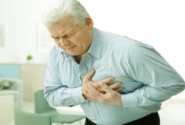 infarctus, infarctus du myocarde, le myocarde, maladies du cœur, athérosclérose,AVC